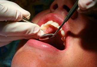 Dental Cleaning