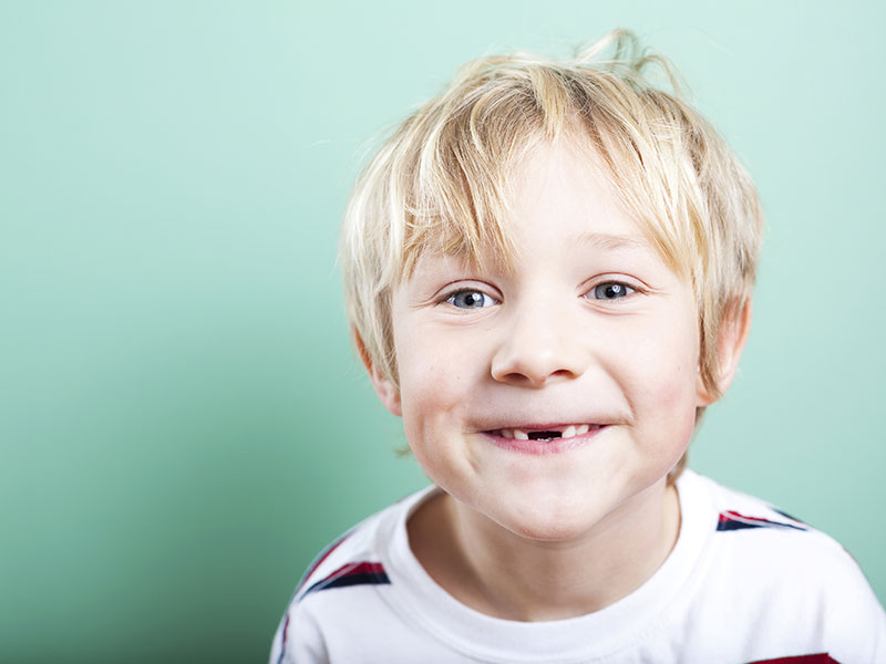 Boy with missing front teeth